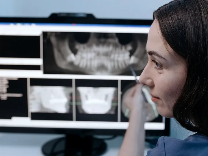 Dental X-ray images displayed on a monitor